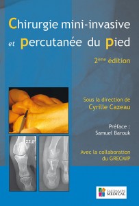 chirurgie mini-invasive et percutanée du pied, Cyrille Cazeau, Yves Stiglitz, GRECMIP