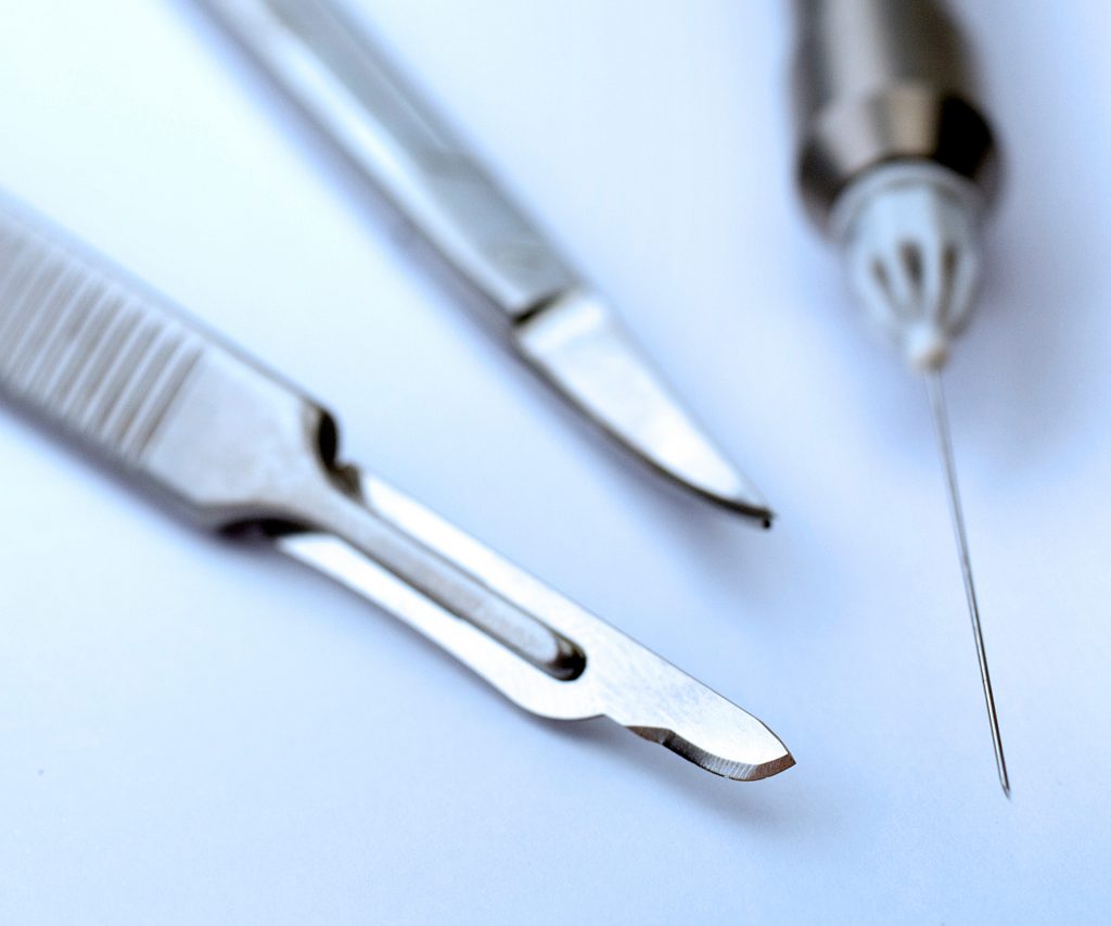 Se faire opérer ? - Chirurgie du Pied